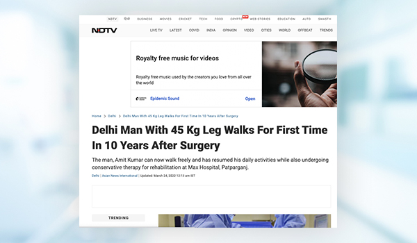 International College-of Surgeons, Plastic Surgeon in Vaishali, Plastic Surgeon in Noida, Best Plastic Surgeon in East Delh